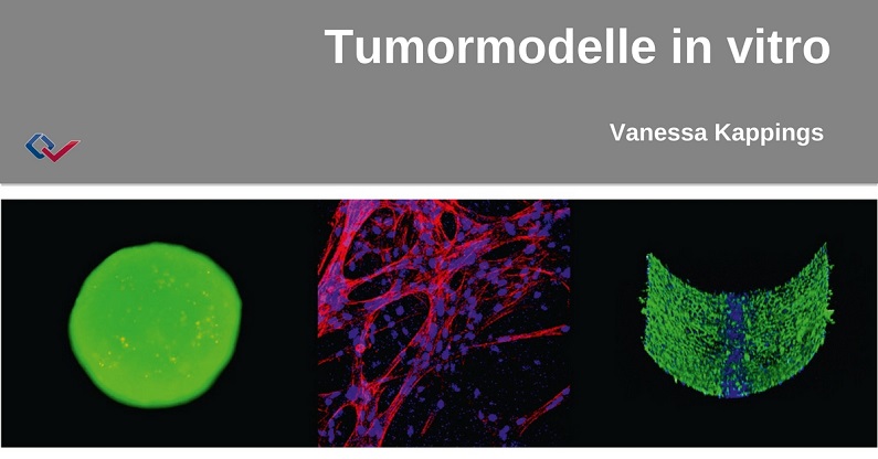 Vanessa Kappings: „Tumormodelle in vitro“