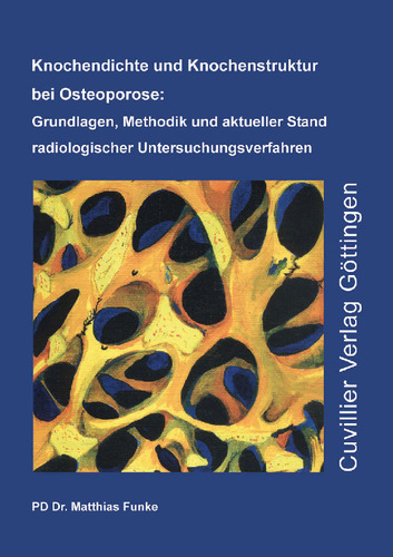 Knochendichte und Knochenstruktur bei Osteoporose: Grundlagen, Methodik und aktueller Stand radiologischer Untersuchungsverfahren