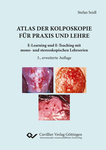 Atlas der Kolposkopie für Praxis und Lehre