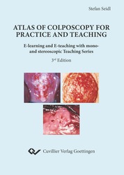 Atlas of Colposcopy for Practice and Teaching