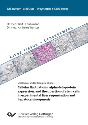 Cellular fluctuations, alpha-fetoprotein expression, and the question of stem cells  in experimental liver regeneration and hepatocarcinogenesis
