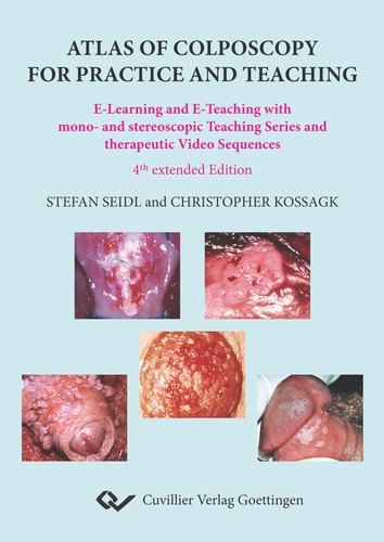 Atlas of Colposcopy for Practice and Teaching